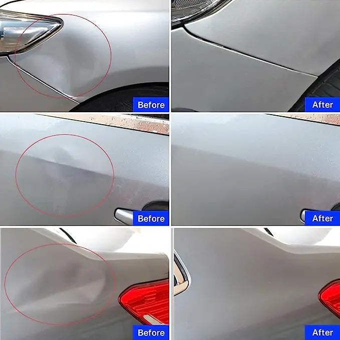 Auto Dellen Reparaturset Lackschonend Universal X-01